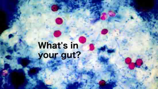 illustration Cyclospora whats in your gut