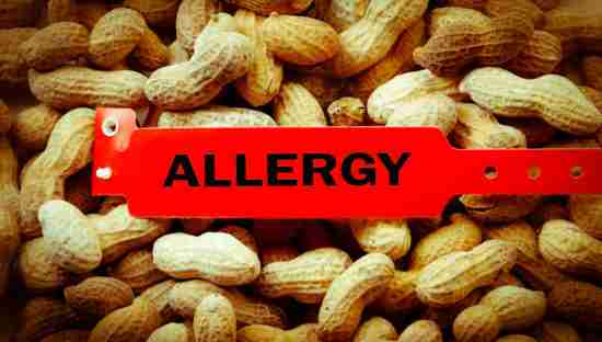 Allergy bracelet over top a pile of peanuts