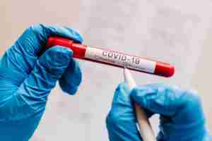 coronavirus employee testing